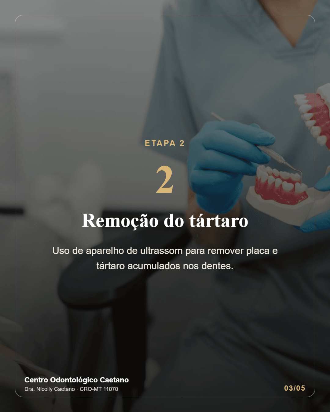 Slide 3 do carrossel: etapa 2, remoção do tártaro