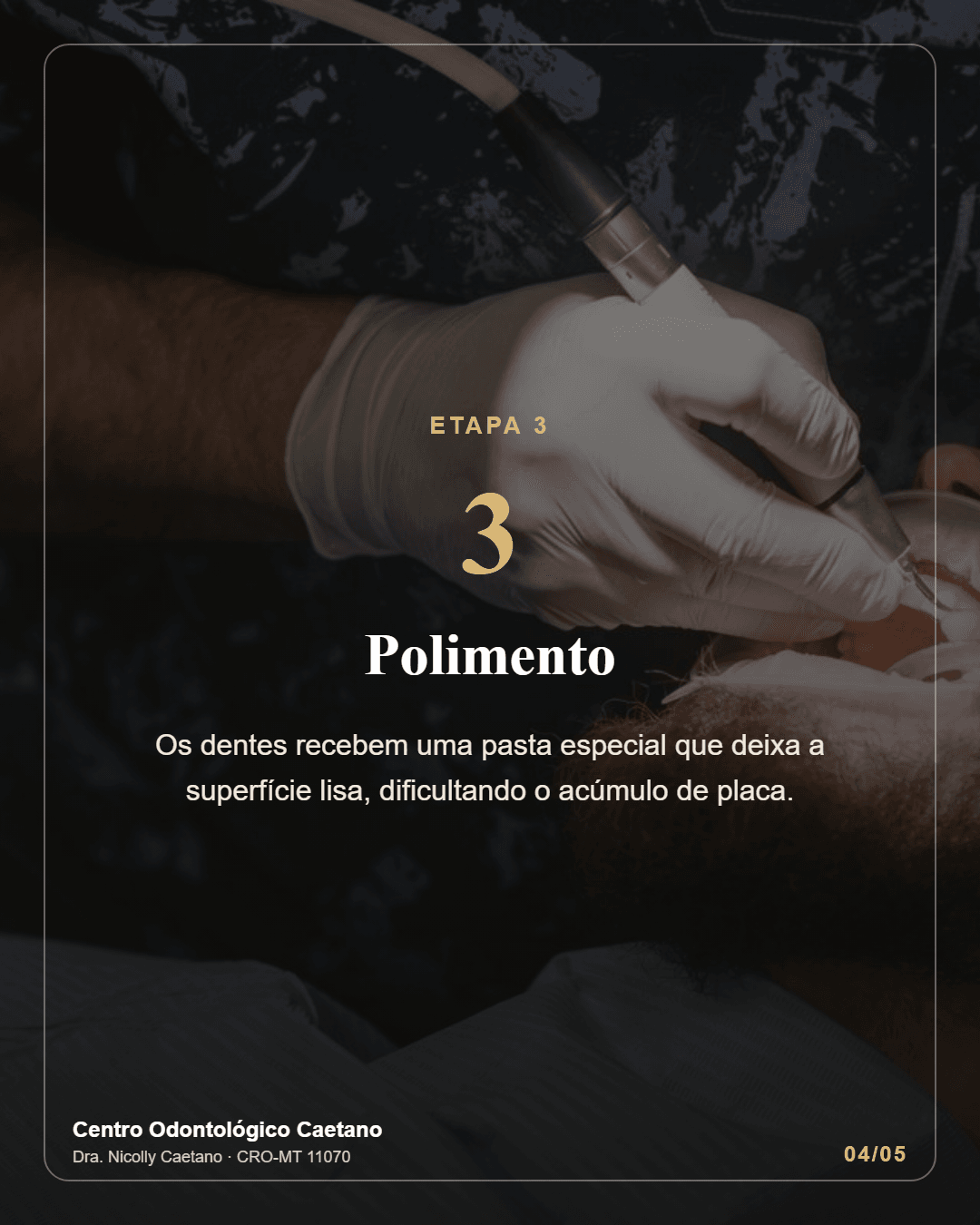 Slide 4 do carrossel: etapa 3, polimento